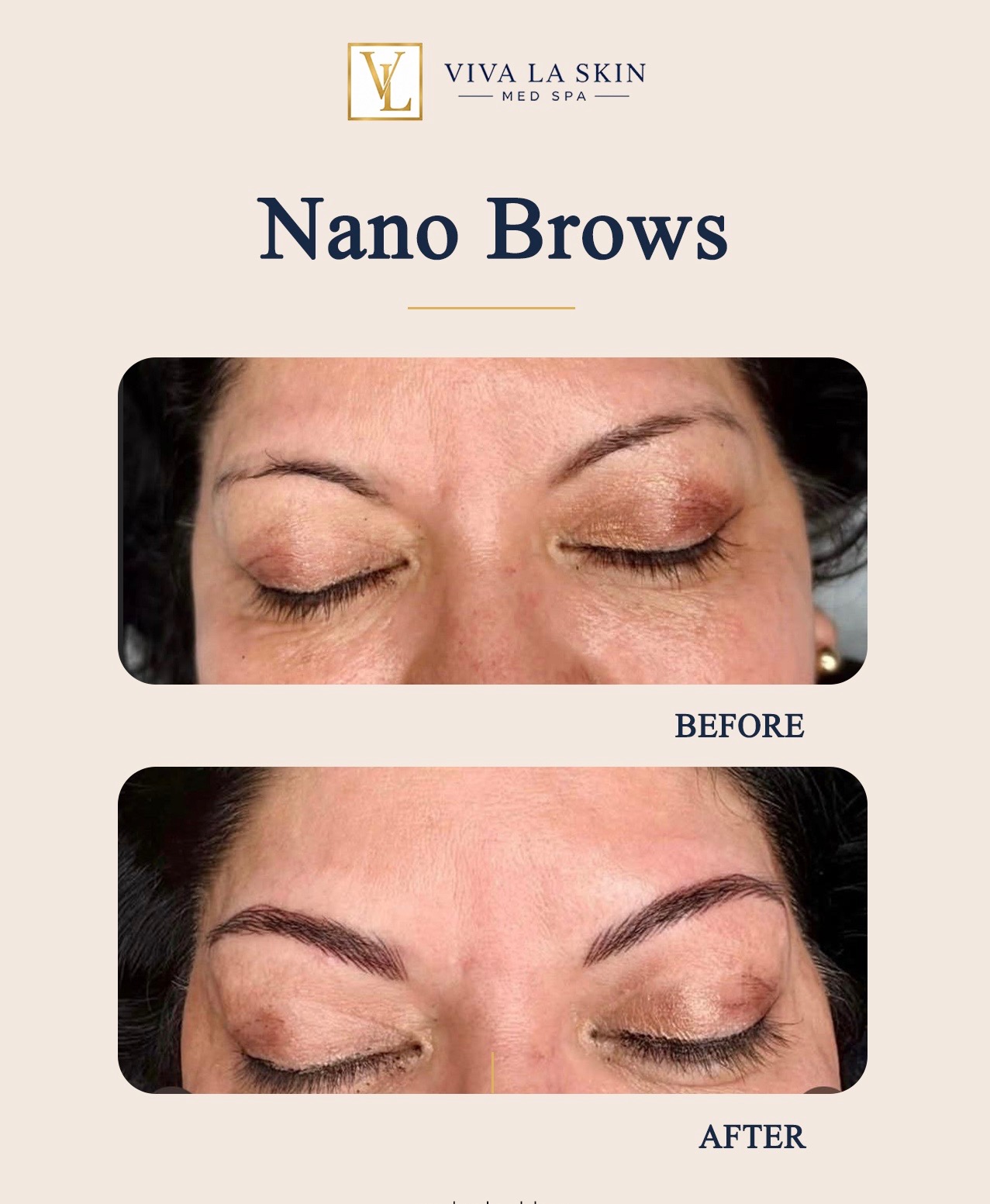 Brows before and after result at Viva La Skin Med Spa in Myrtle Beach