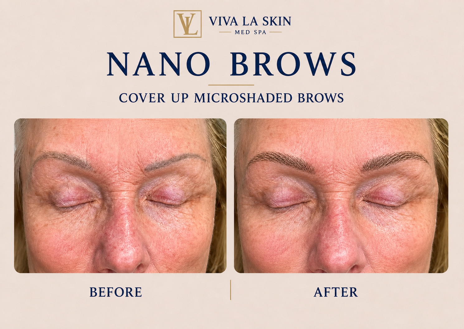 Brows before and after result at Viva La Skin Med Spa in Myrtle Beach