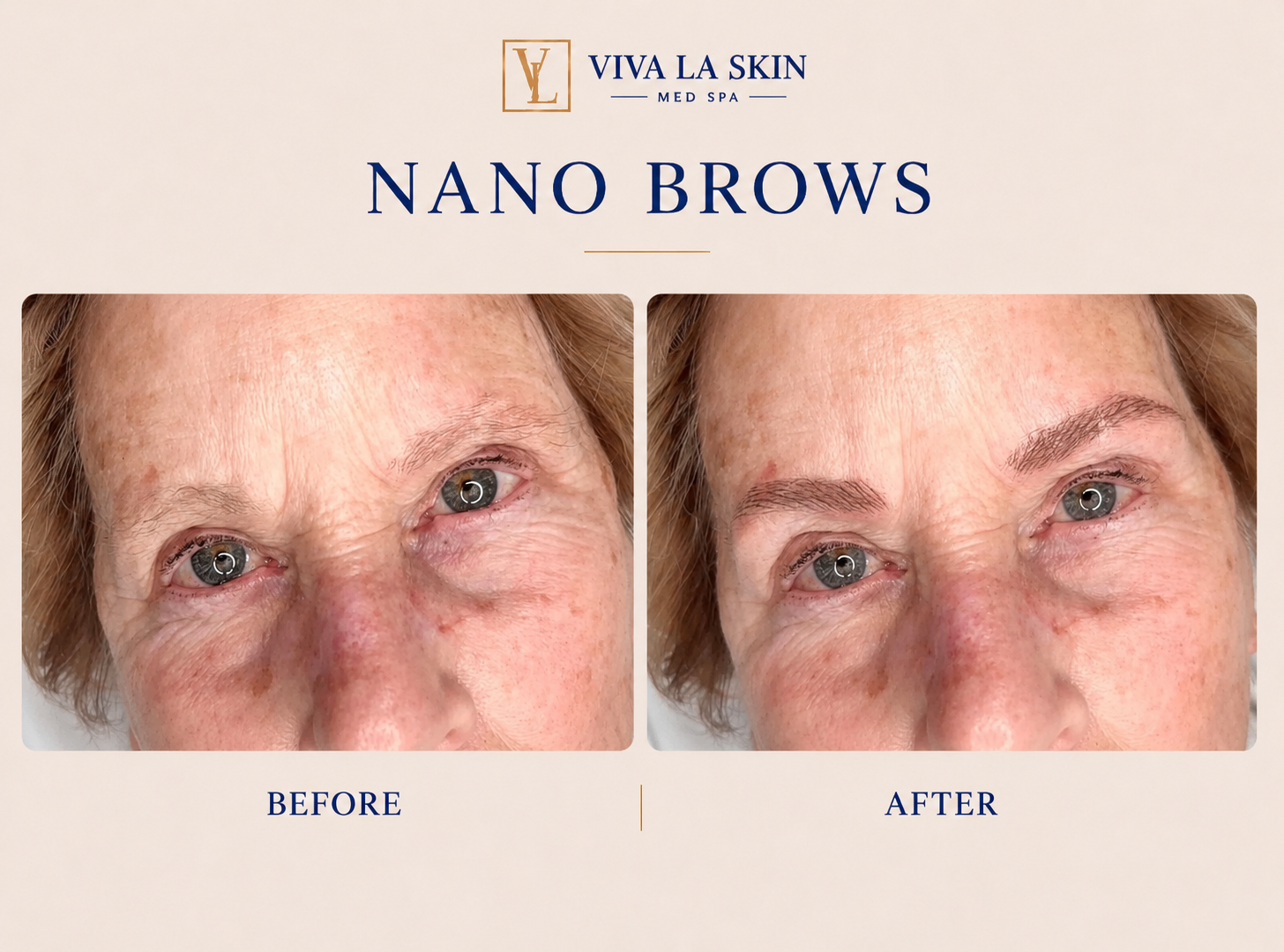 Brows before and after result at Viva La Skin Med Spa in Myrtle Beach