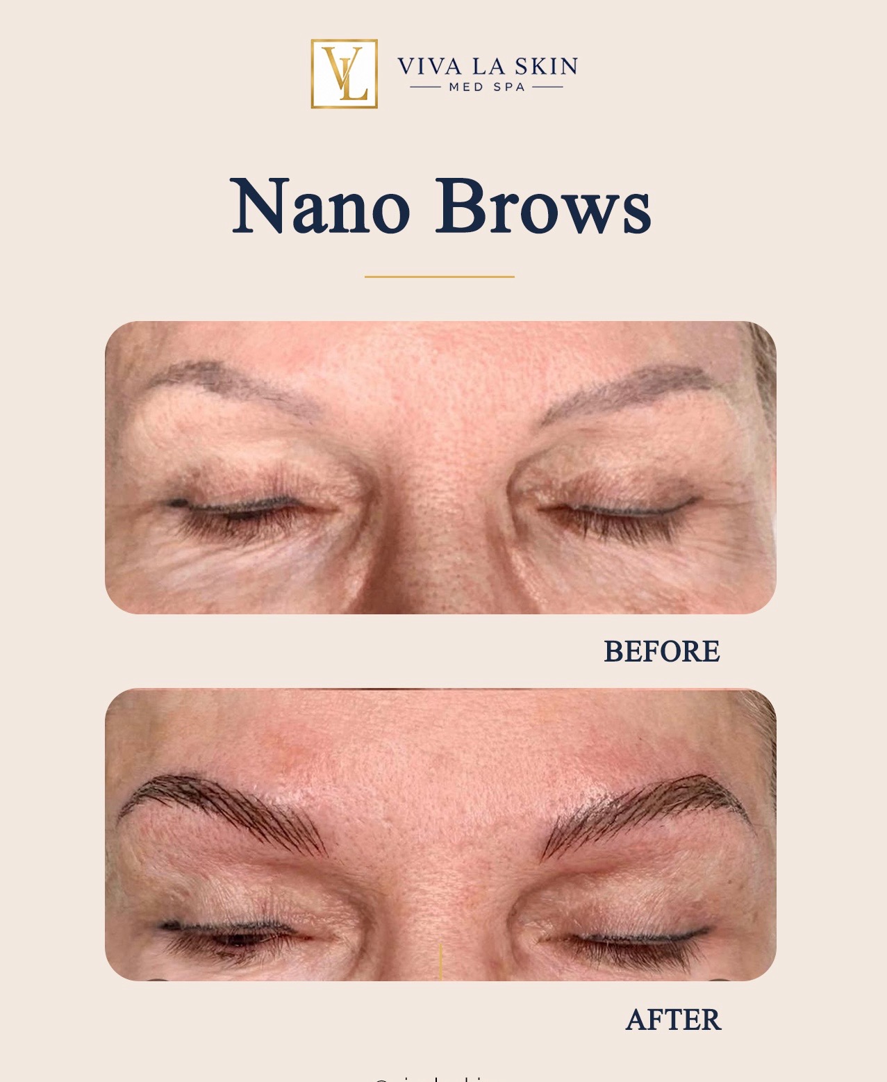 Brows before and after result at Viva La Skin Med Spa in Myrtle Beach