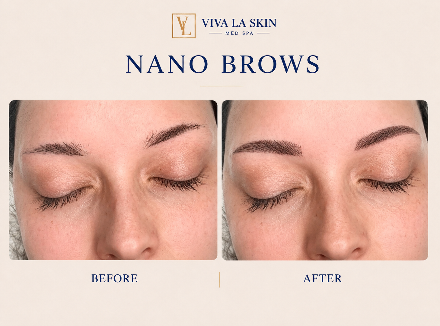Brows before and after result at Viva La Skin Med Spa in Myrtle Beach