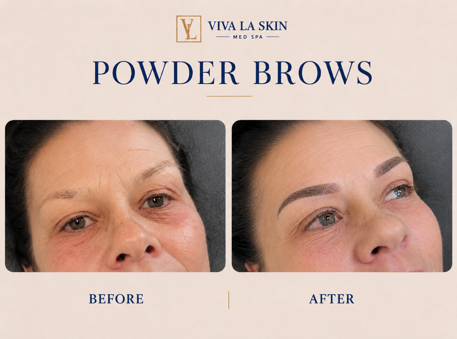 Brows before and after result at Viva La Skin Med Spa in Myrtle Beach