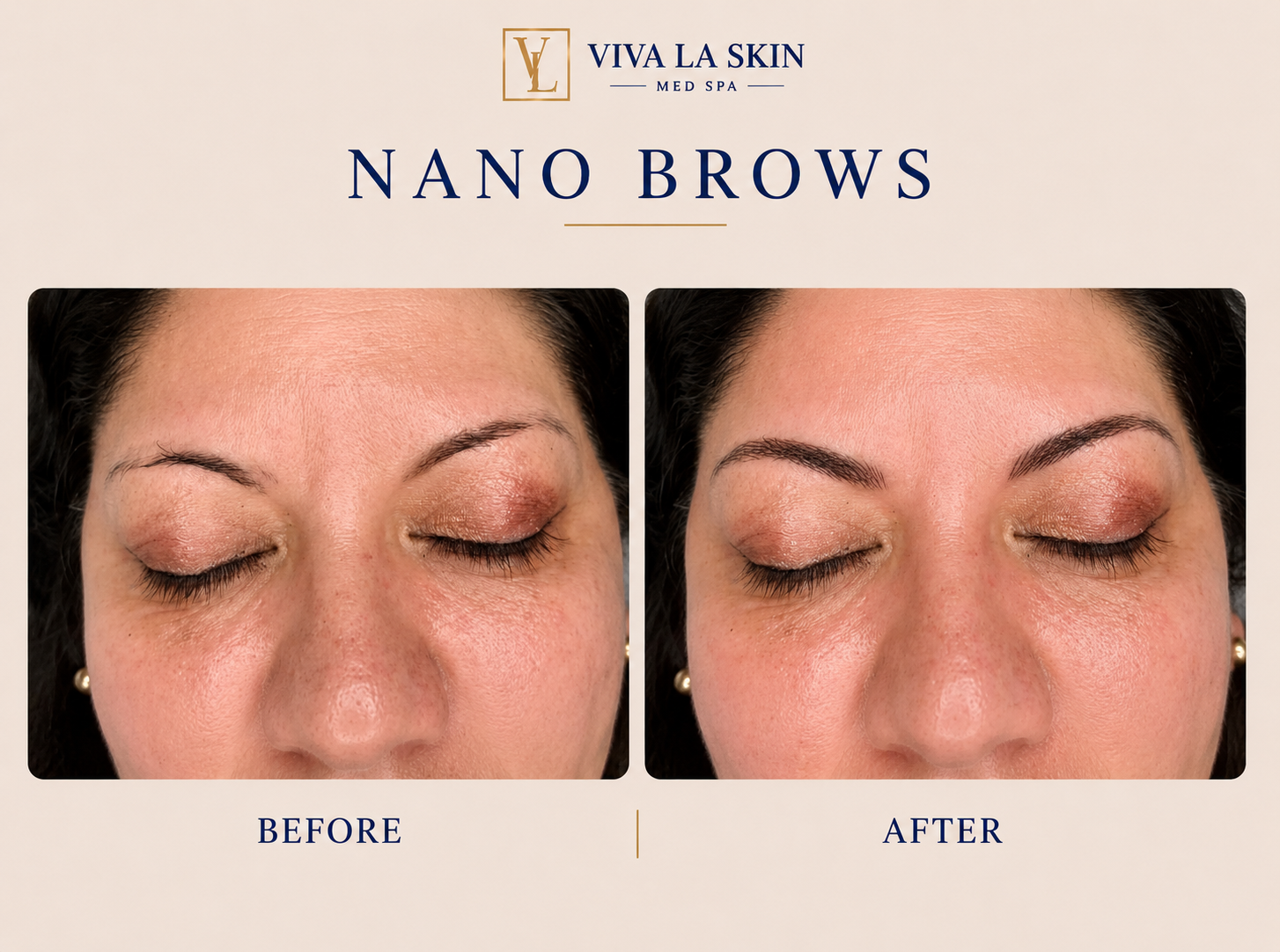 Brows before and after result at Viva La Skin Med Spa in Myrtle Beach