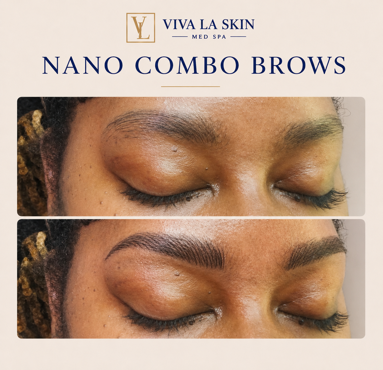 Brows before and after result at Viva La Skin Med Spa in Myrtle Beach