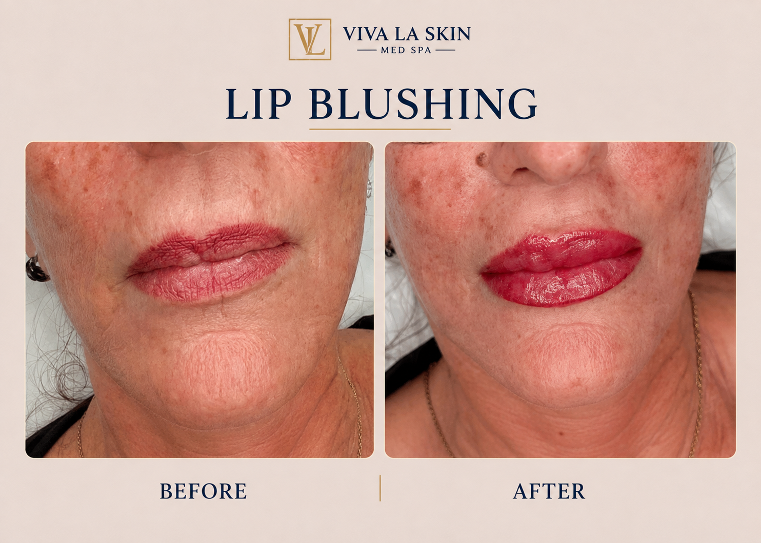 Lip Blushing before and after result at Viva La Skin Med Spa in Myrtle Beach