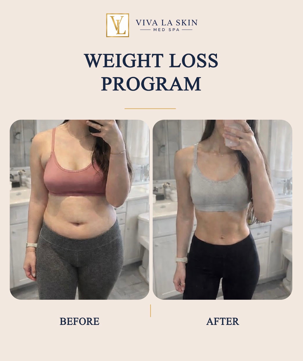 Weight Loss Program before and after result at Viva La Skin Med Spa in Myrtle Beach