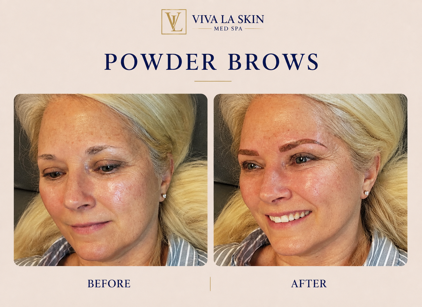Brows before and after result at Viva La Skin Med Spa in Myrtle Beach