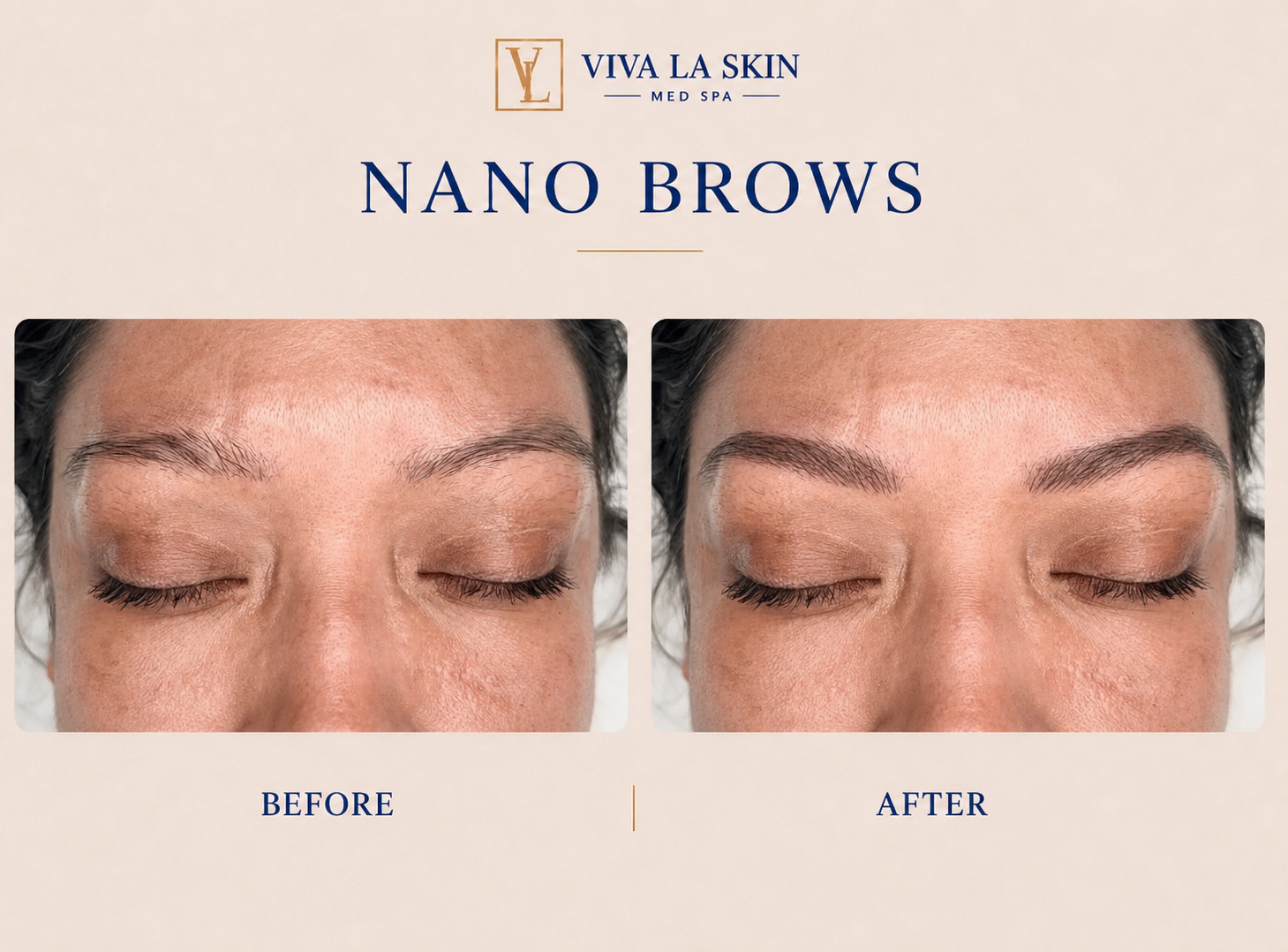 Brows before and after result at Viva La Skin Med Spa in Myrtle Beach