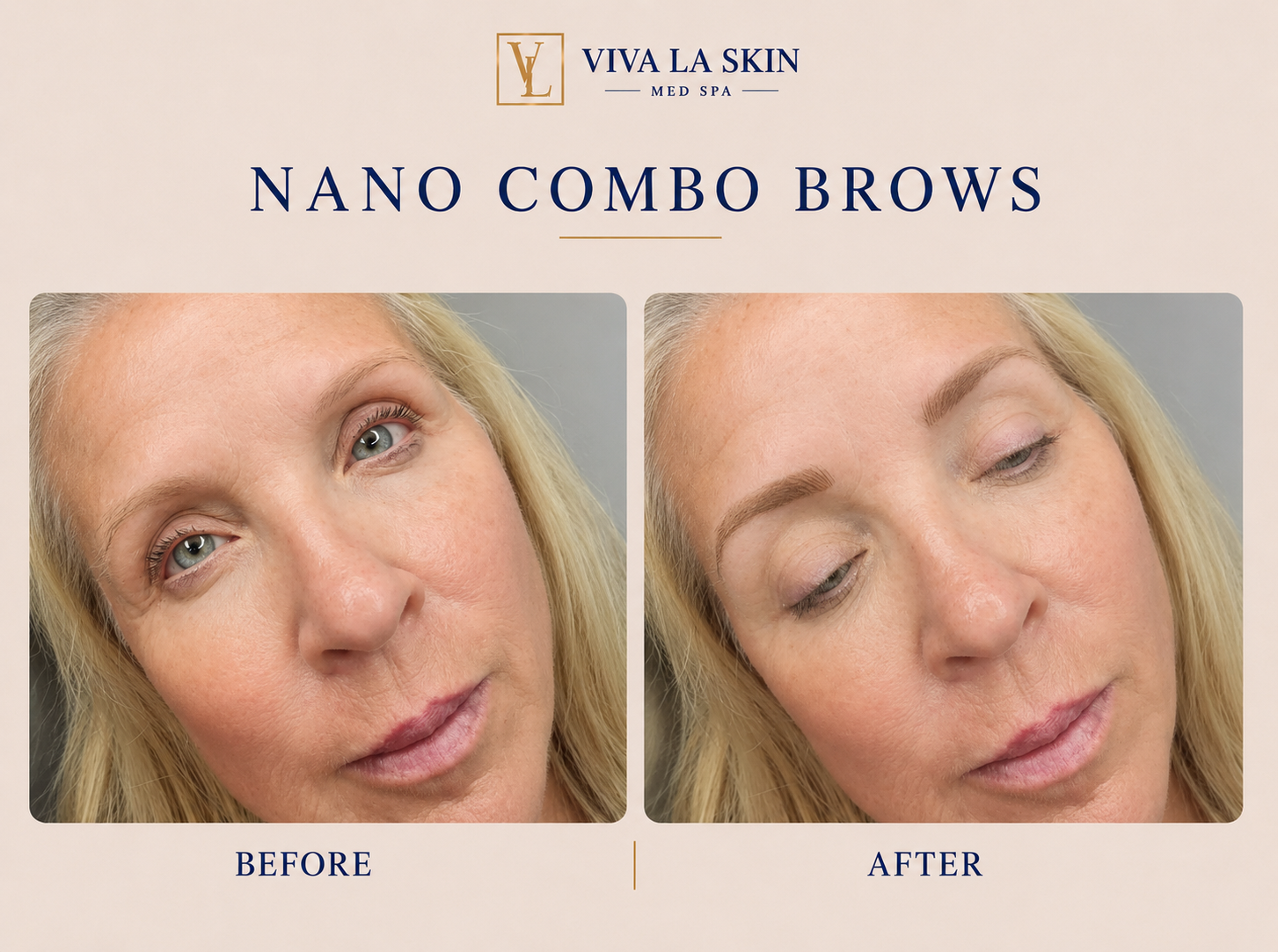 Brows before and after result at Viva La Skin Med Spa in Myrtle Beach