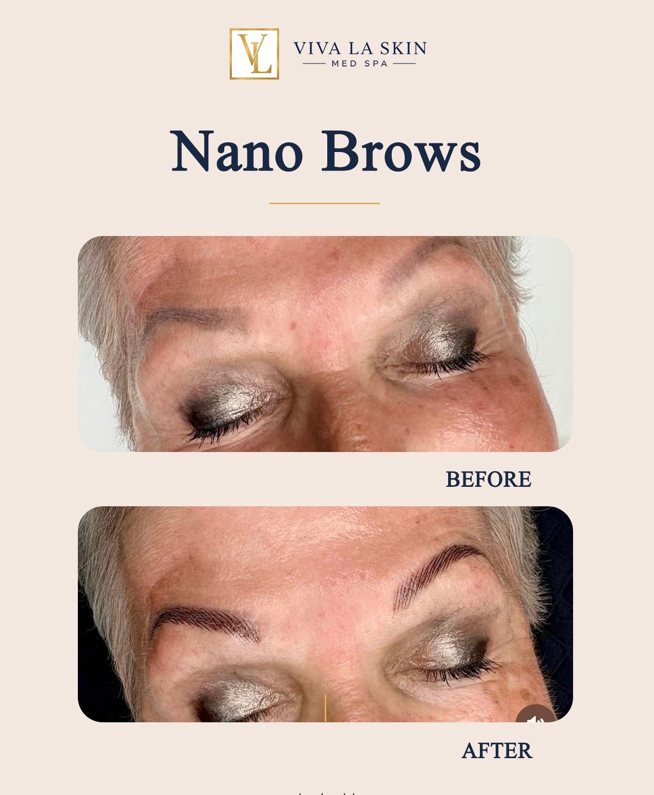 Brows before and after result at Viva La Skin Med Spa in Myrtle Beach