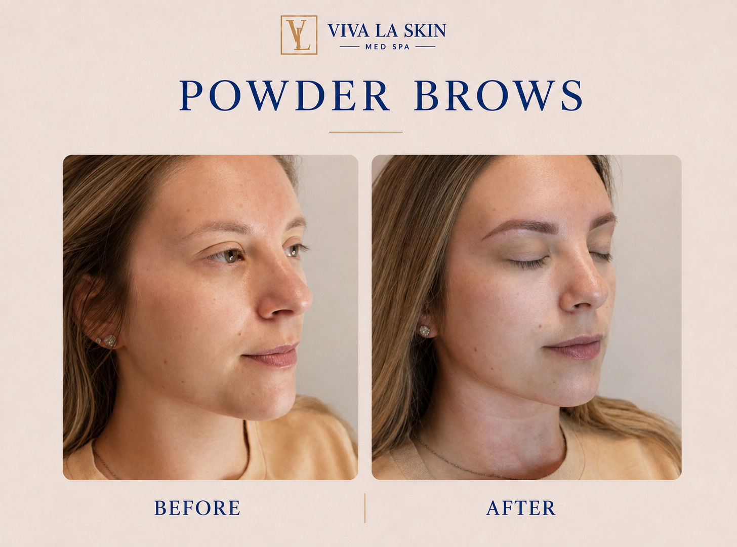 Brows before and after result at Viva La Skin Med Spa in Myrtle Beach