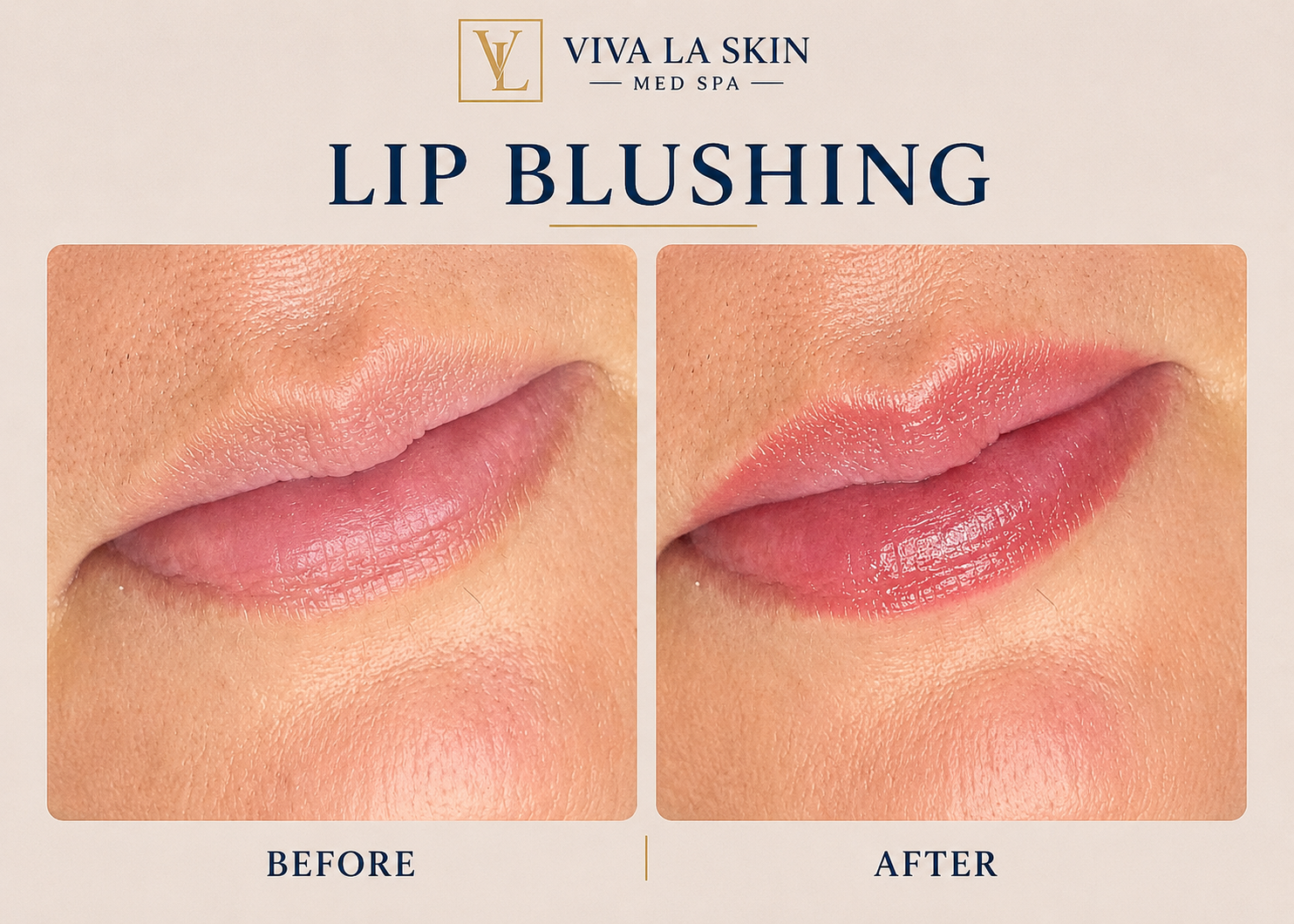 Lip Blushing before and after result at Viva La Skin Med Spa in Myrtle Beach